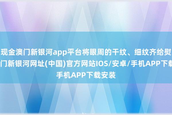 現金澳門新銀河app平臺將眼周的干紋、細紋齊給熨平-澳門新銀河網址(中國)官方網站IOS/安卓/手機APP下載安裝